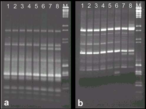 ERIC-PCR (a) and RAPD profiles (b) of representative cefotaxime-resistant and susceptible S.typhimurium isolates