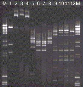 Digestion patterns of CTX-M-beta-lactamase-encoding plasmids