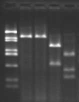 blaCTX-M-gene amplification products and their RFLP patterns obtained with Pst I-Pvu II restriction endonucleases.