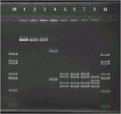 Agarose gel electrophoresis of blaSHV-1 and blaSHV-2 amplification products and their restriction enzyme digests.