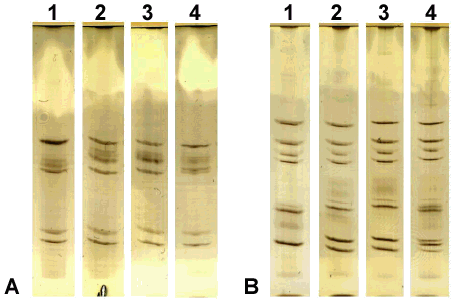 Selected SSCP profiles of blaTEM genes obtained with the combinations of restriction endonucleases Taq I - Pst I (A) and Taq I - Ava II (B).