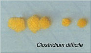 Clostridium difficile