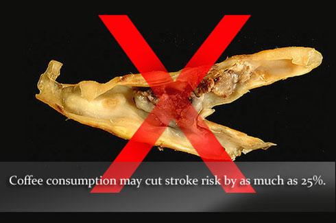Употребление кофе снижает риск инсультов на 25%