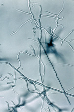 Streptomyces