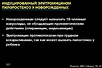 Индуцированный эритромицином пилоростеноз у новорожденных